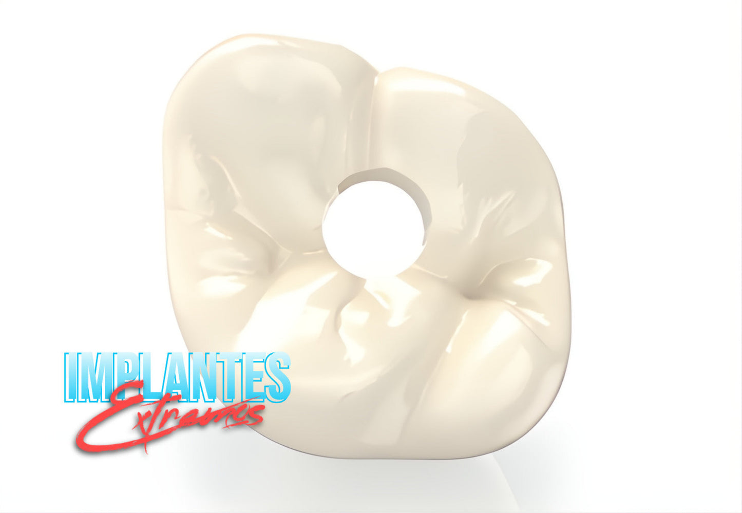 Unidad de Zirconio Extremo sobre Implantes